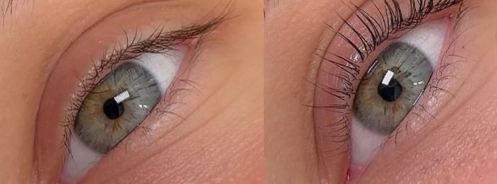 Wimpernlifting – die besten Sets